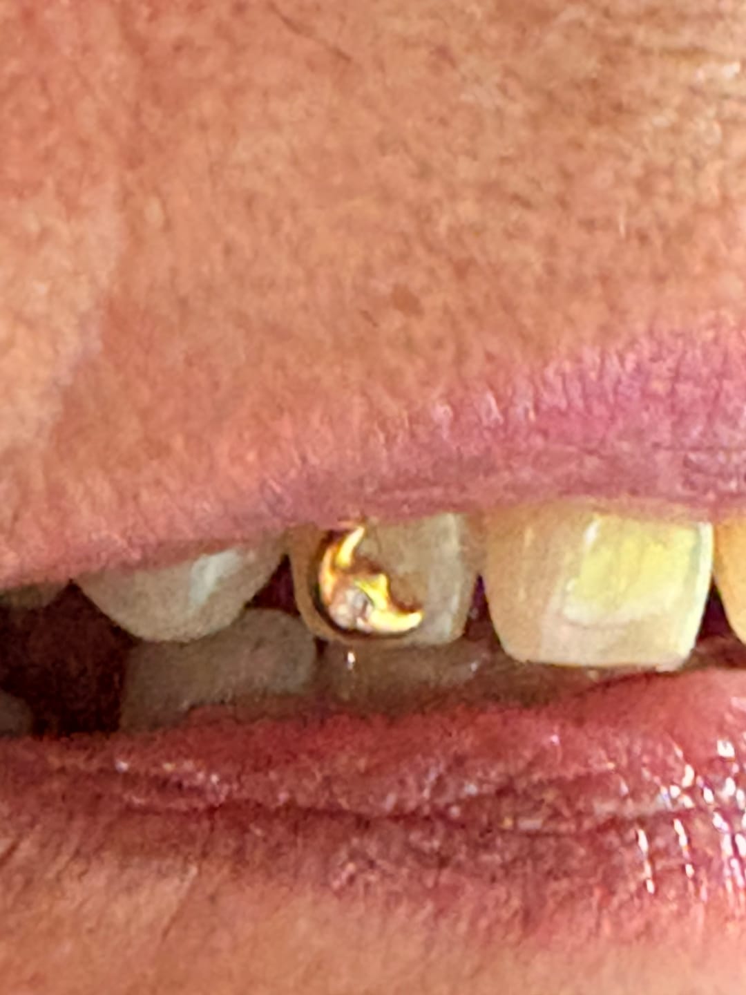 Customer photo review of Crystal Clear 1.8mm Preciosa® Tooth Gem Crystals – 6-pack