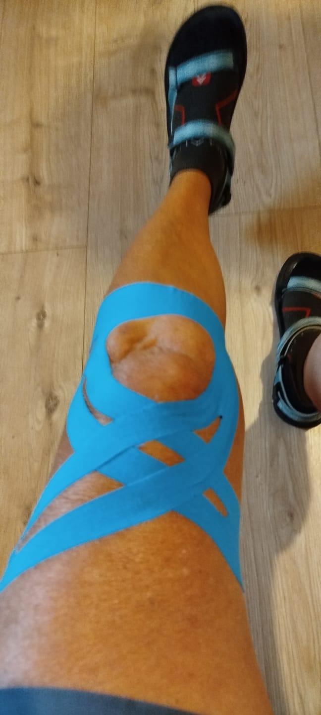 Customer photo review of Bandes kinésio prédécoupées pour genou