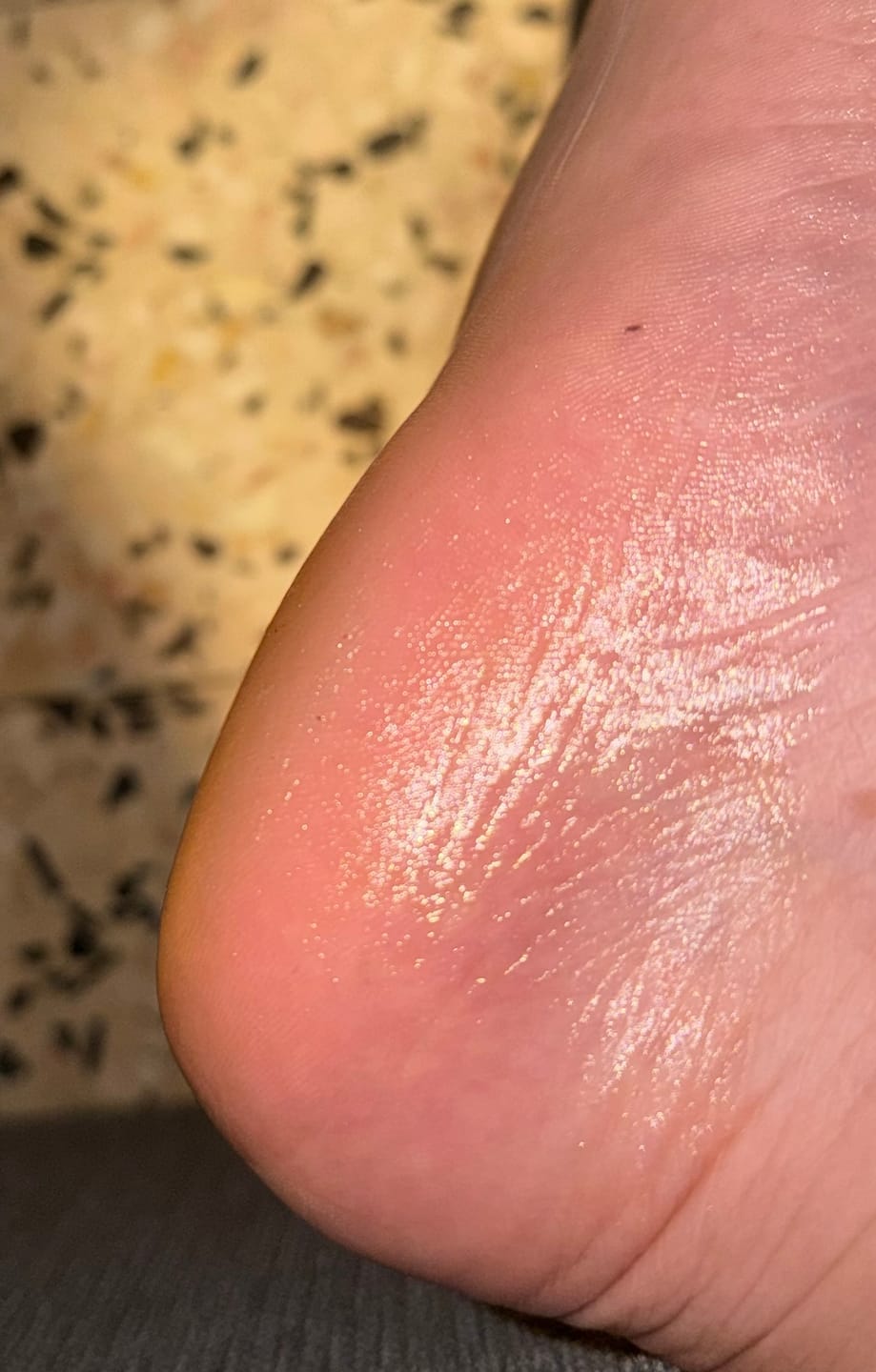 Customer photo review of Foot Balm