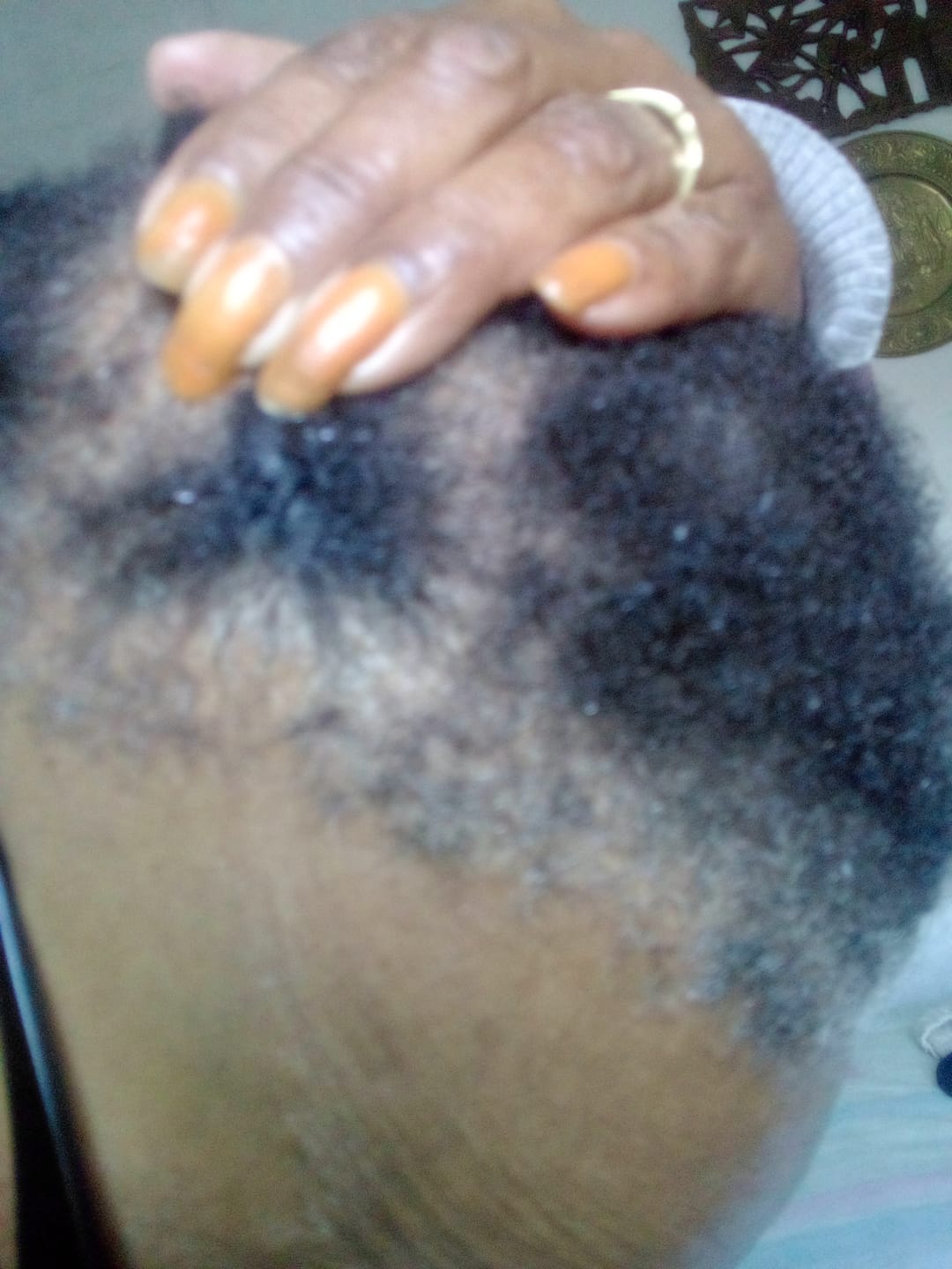 Customer photo review of Hair & Nail Capsules