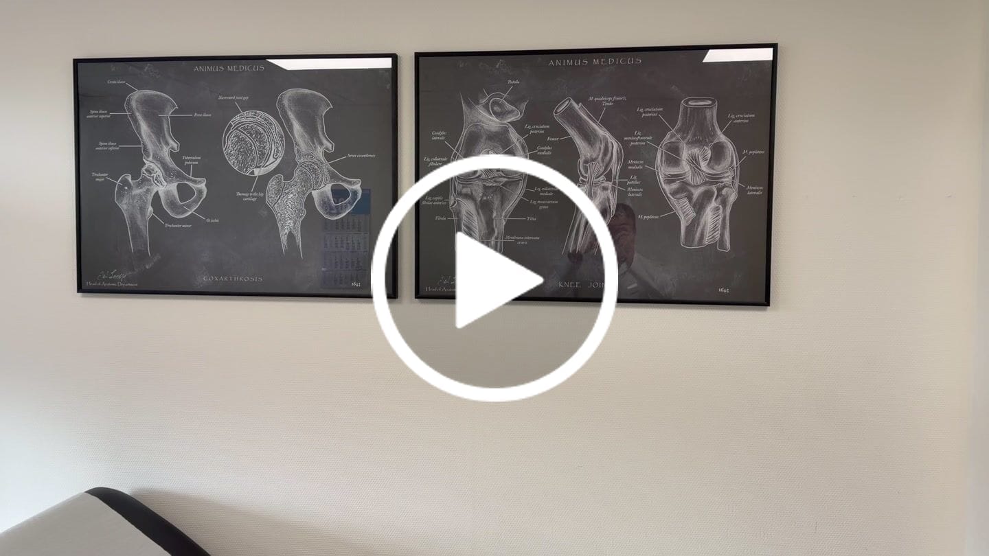 Customer video review of Hüftarthrose - Chalkboard