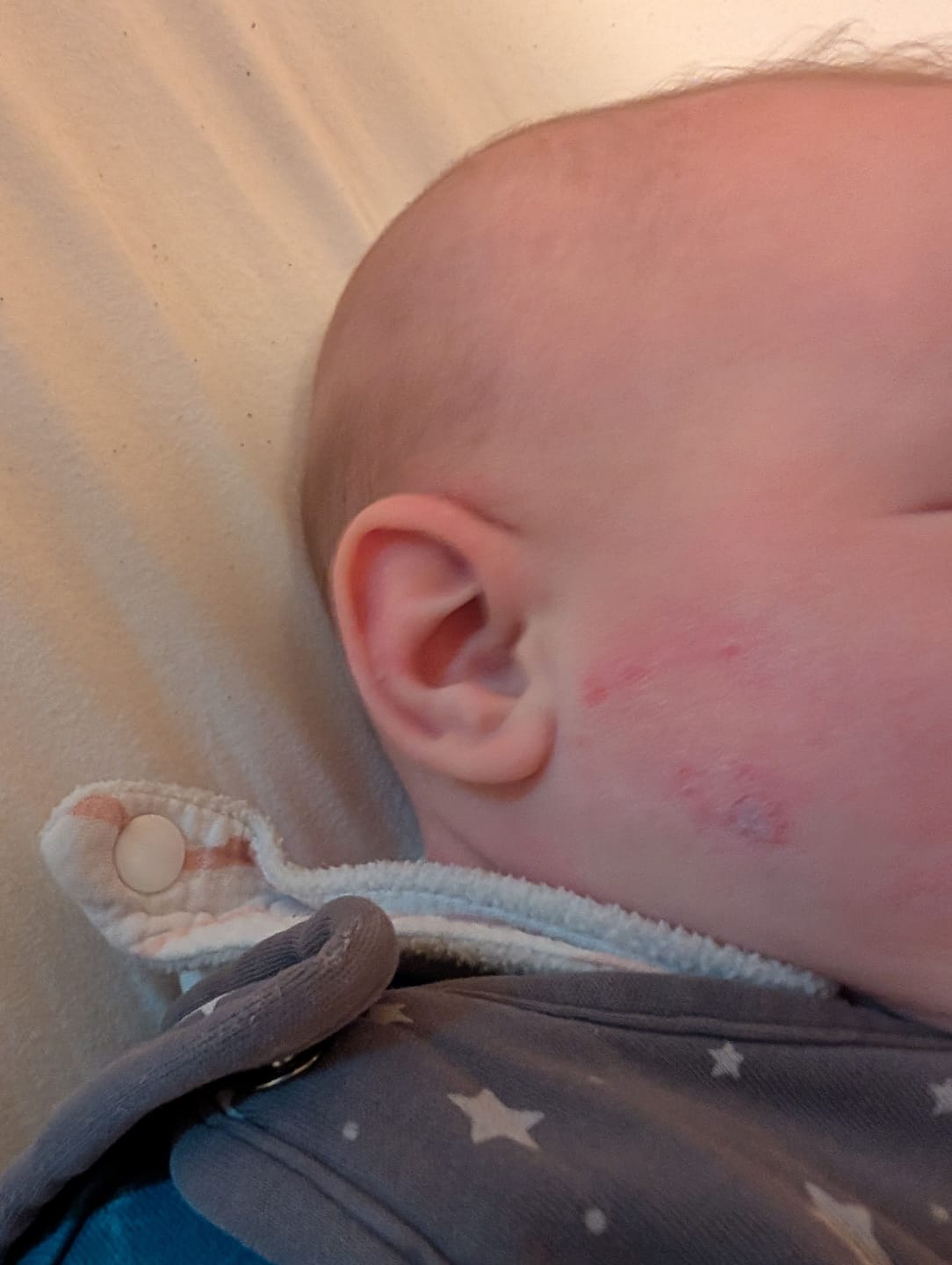 Customer photo review of Baby Barrier Gel