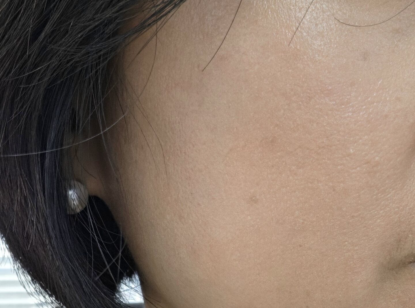 Customer photo review of Skin Blemish Balm Intensive (6 Shades)