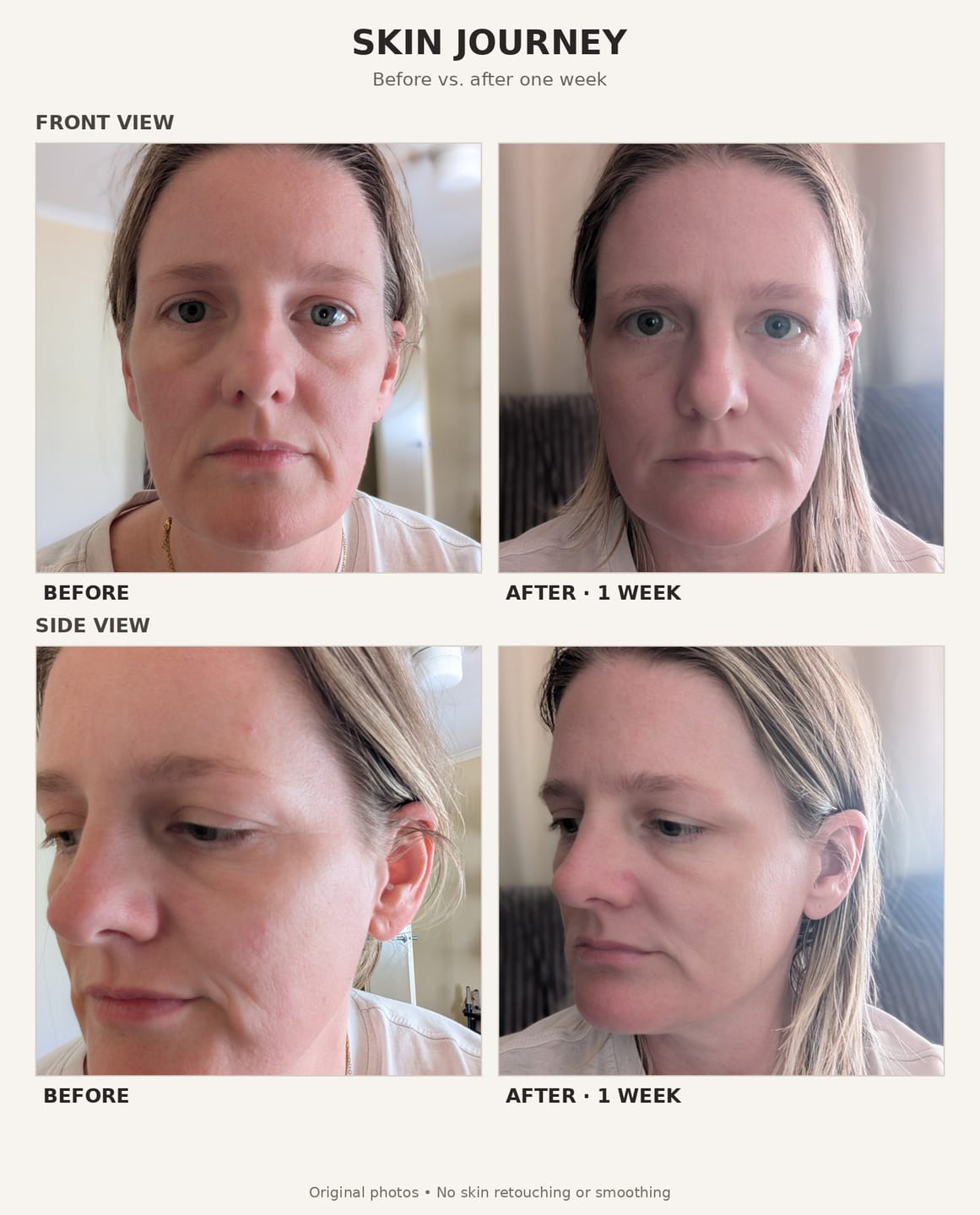 Customer photo review of Expert Lab Exosome Hydro-Regenerating Cream