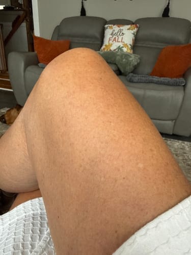 Customer photo review of Botanical Body Oil™