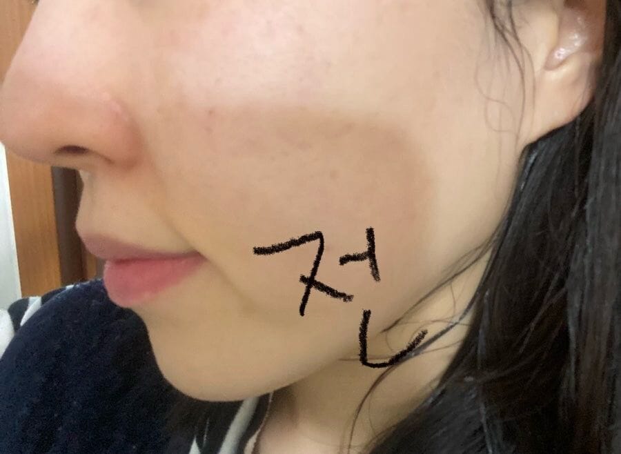 Customer photo review of Post Alpha First Cooling Mask (5 sheets)