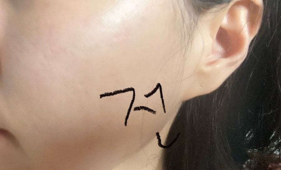 Customer photo review of Cica Cooling Mask (5 sheets)