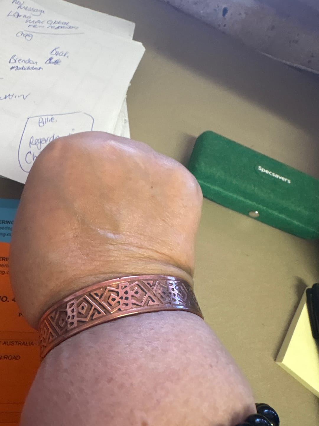 Customer photo review of Wikay / Magnetic / Copper Bracelet