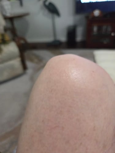 Customer photo review of Botanical Body Oil™