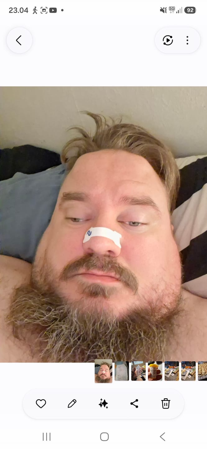 Customer photo review of Nuku Sleep Nasal Strips