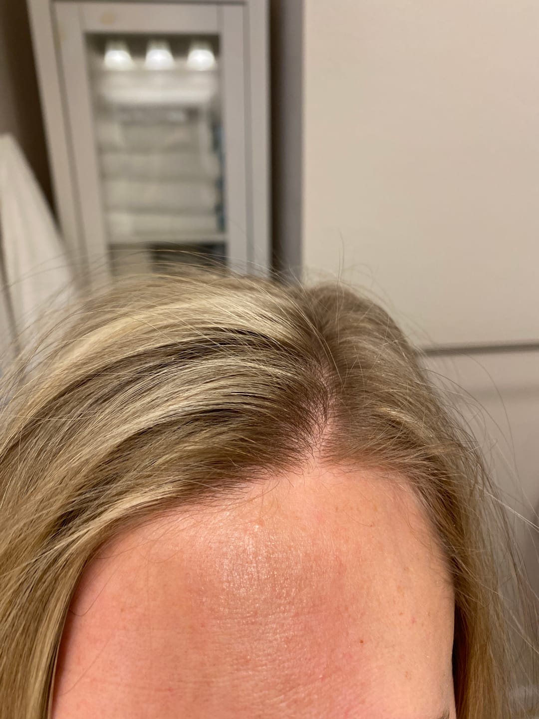 Customer photo review of Travel Dry Shampoo Powder (Non-Aerosol Spray) | Natural & Organic Ingredients | Made in USA