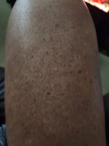 Customer photo review of Botanical Body Oil™