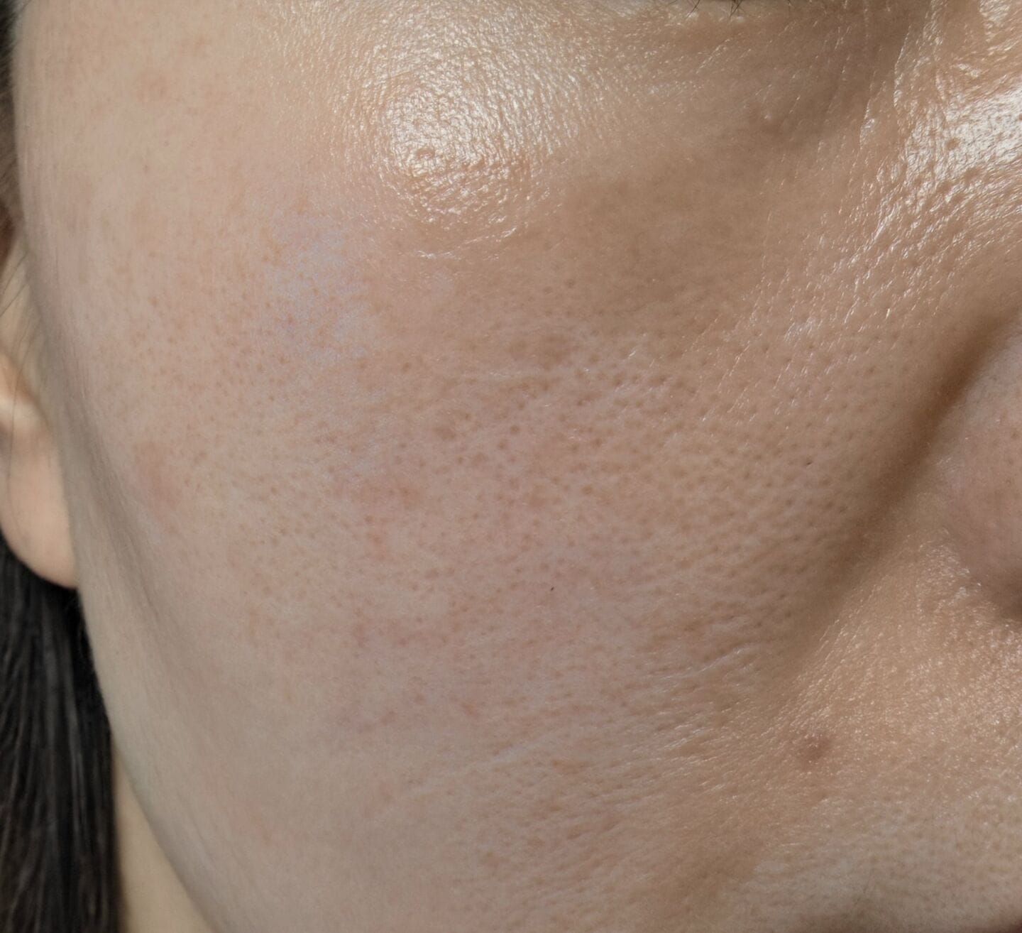 Customer photo review of Skin Blemish Balm Intensive (6 Shades)