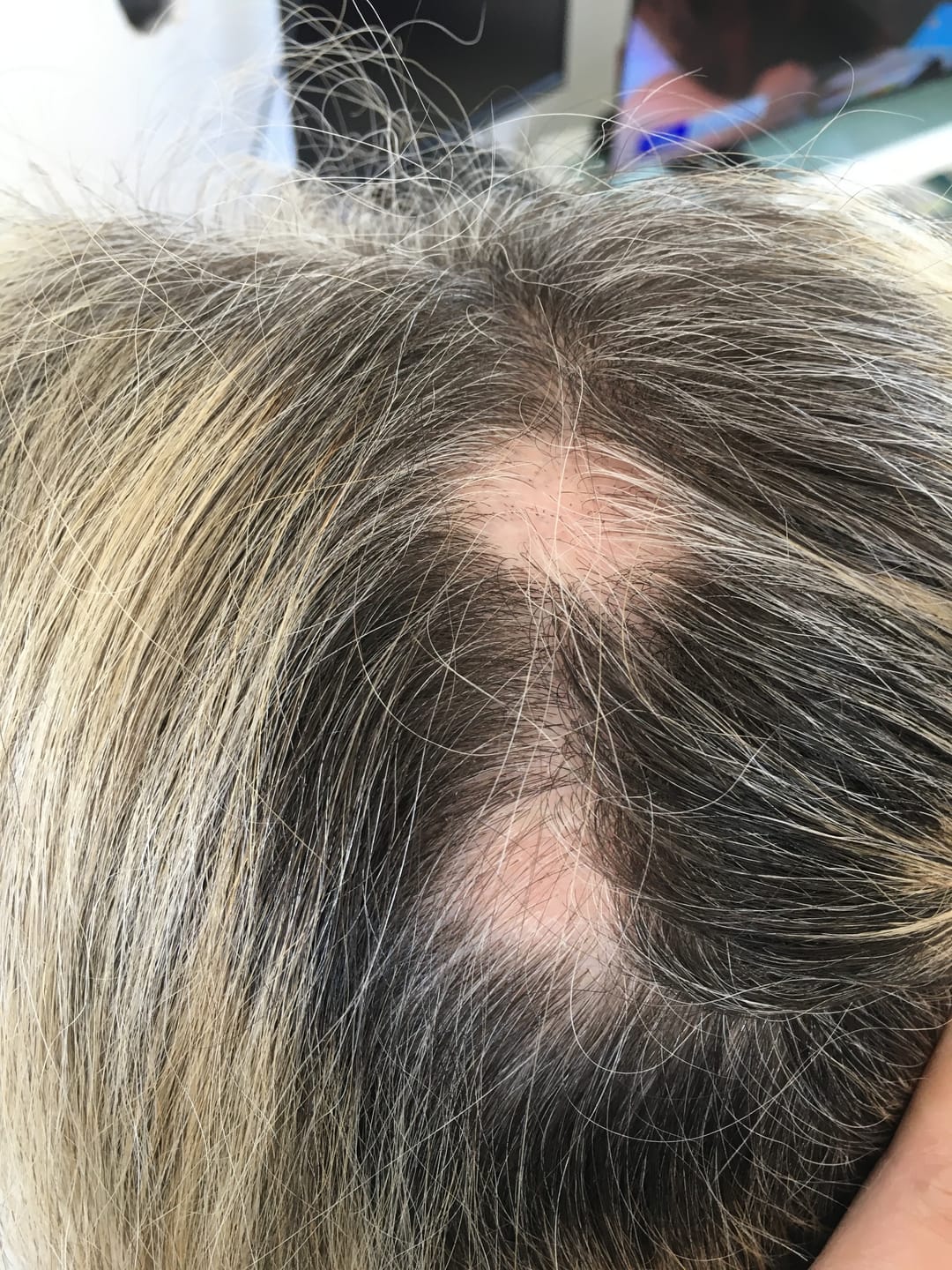 Customer photo review of Good Hair Women Anti-chute - 1 mois