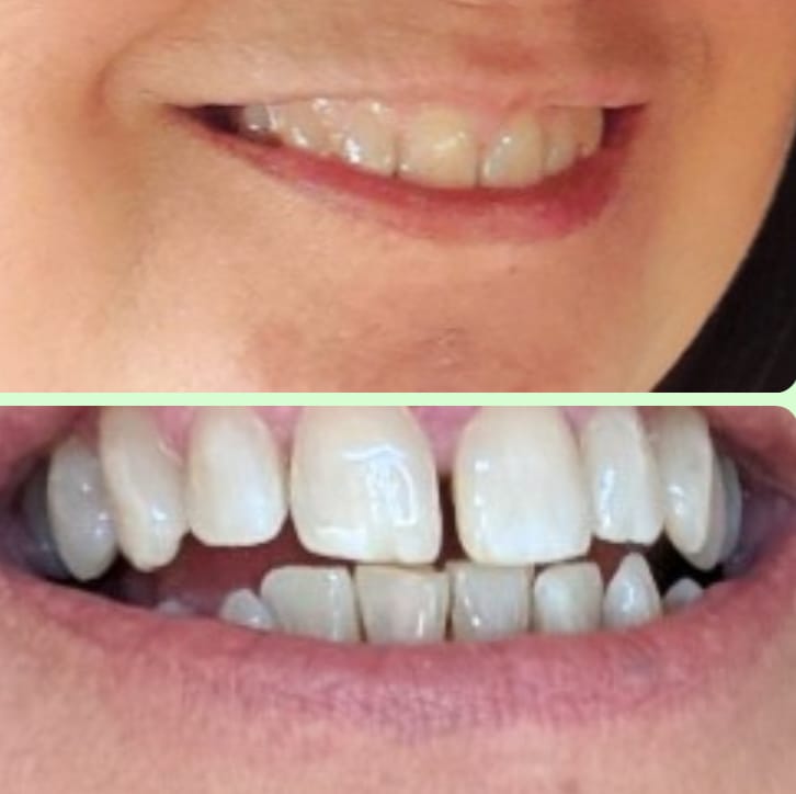 Customer photo review of The Glow Up Kit