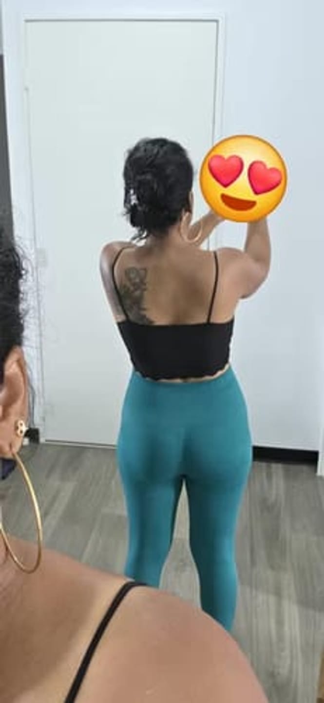 Customer photo review of ActiFlex 3D-Kompressionsleggings