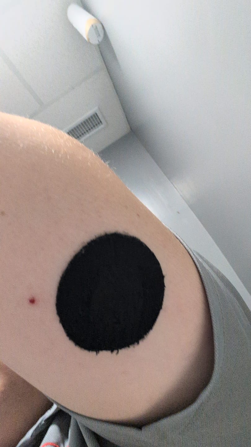 Customer photo review of Skin Grip Original - Libre 3+ Adhesive Patches