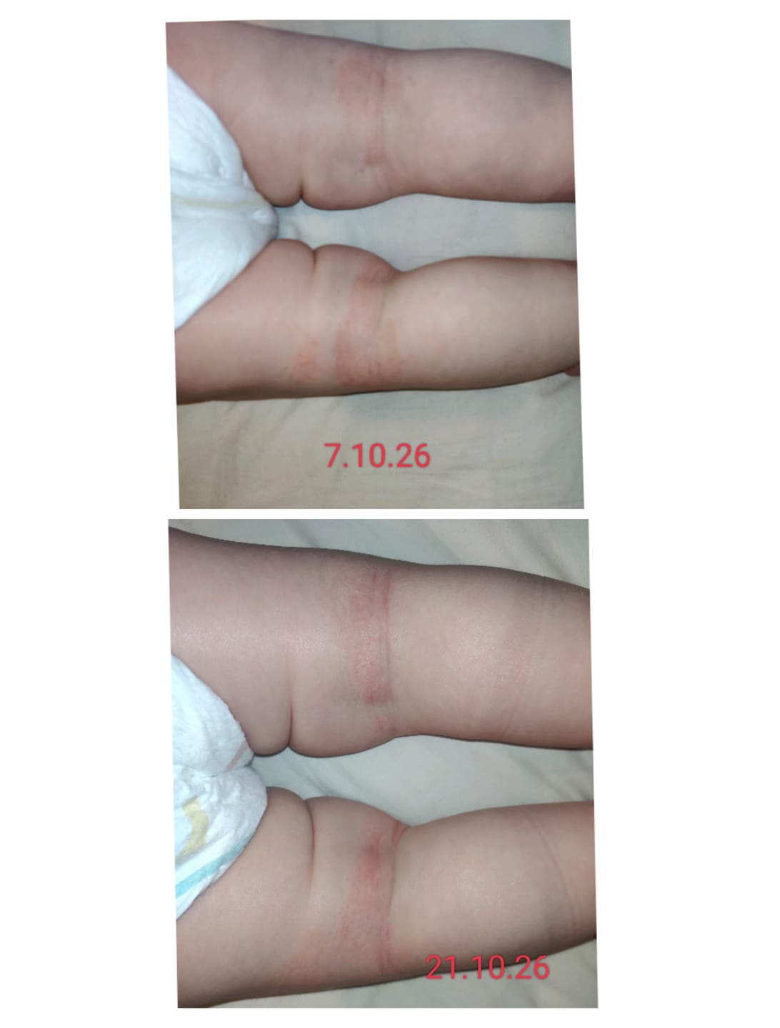 Customer photo review of Silky Sage Talivoide