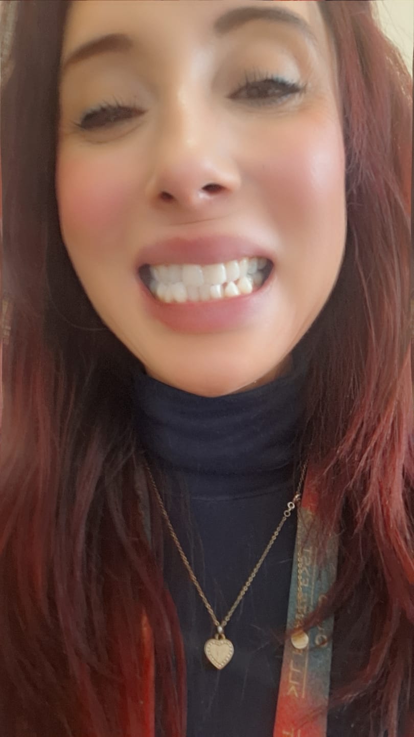 Customer photo review of Teeth Whitening Powder