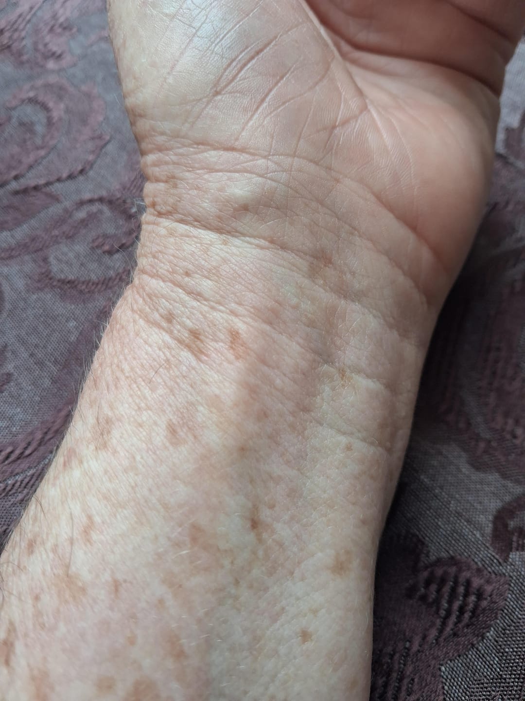 Customer photo review of Anti-Ageing Bundle