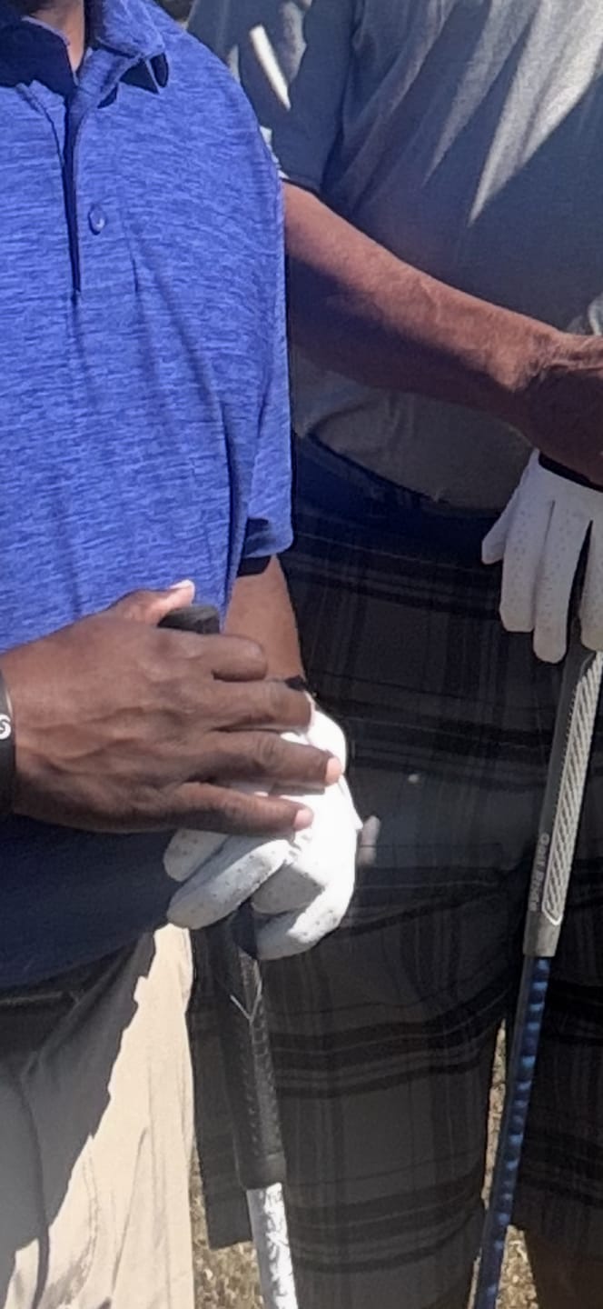 Customer photo review of Holen SureGrip Glove