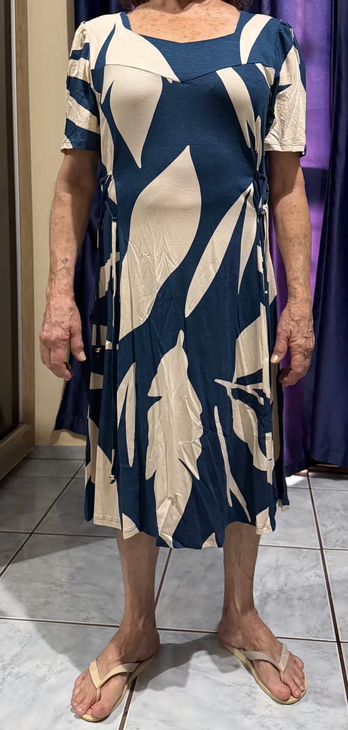 Customer photo review of Vestido Midi Vera Estampado Viscolycra Casual