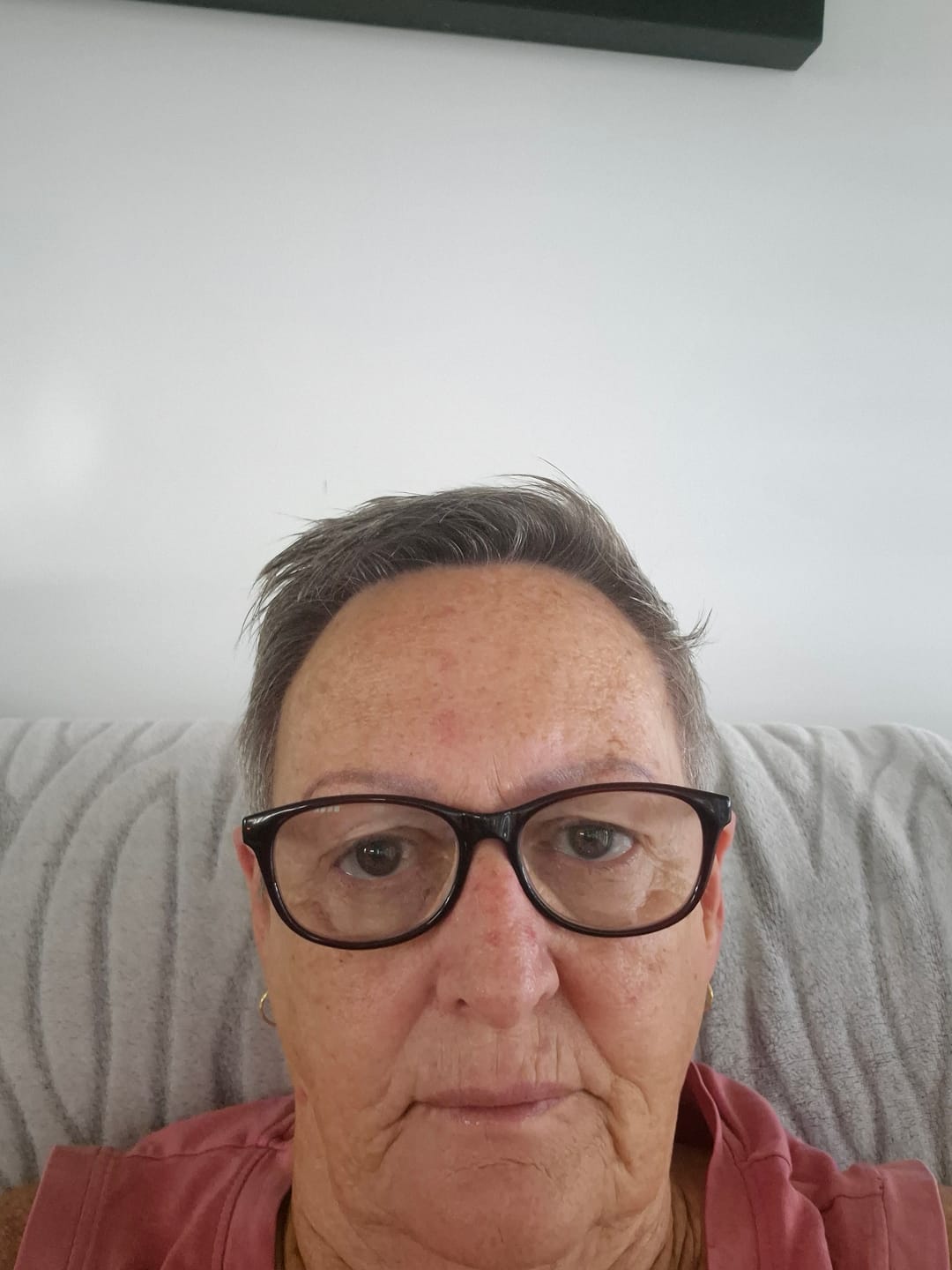 Customer photo review of Restore Serum