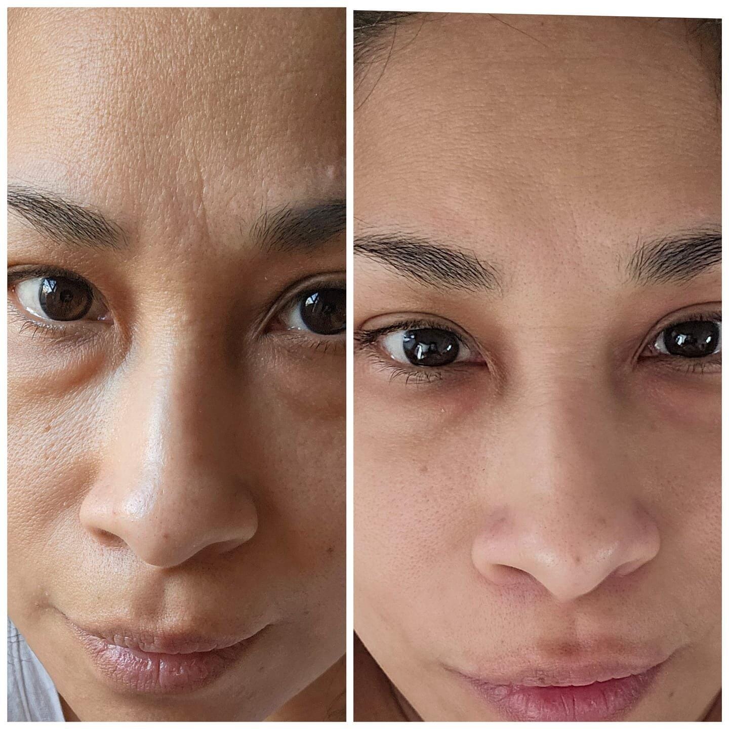 Customer photo review of Bodivra™ Thermal Sculptor