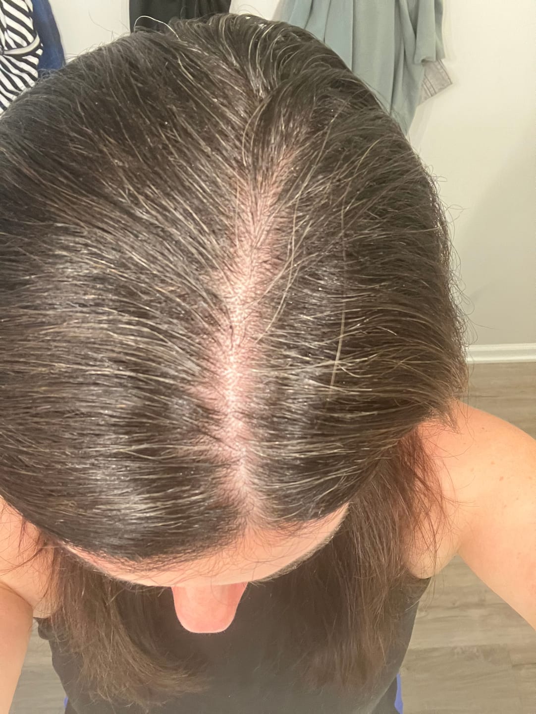 Customer photo review of Magic Revive Hair & Scalp Shampoo