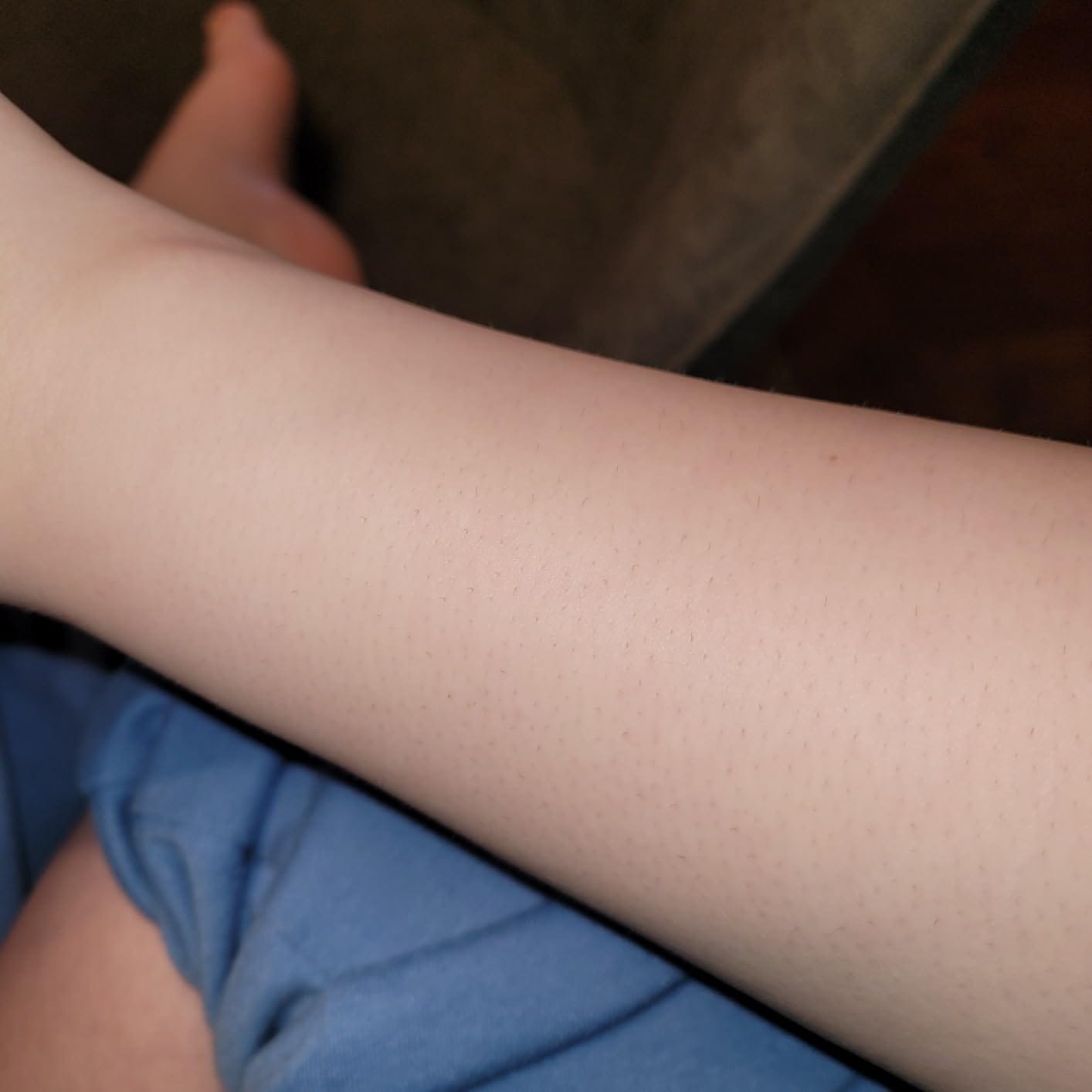 Customer photo review of LuYura™ 2.0 - Intimarkning utan irritation