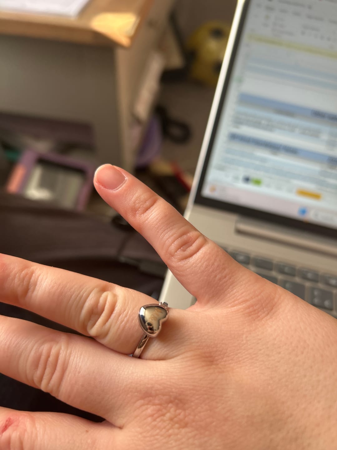 Customer photo review of Heart Locket Ring