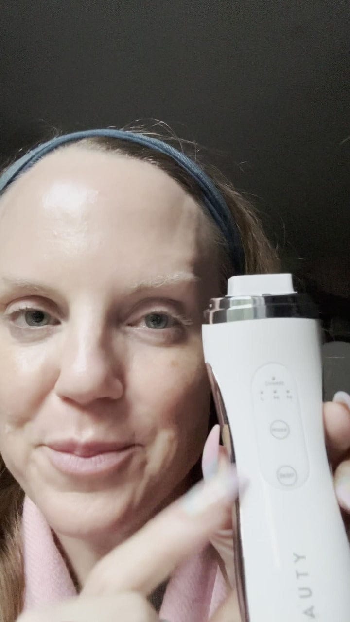 Customer photo review of VEAUTY Dot