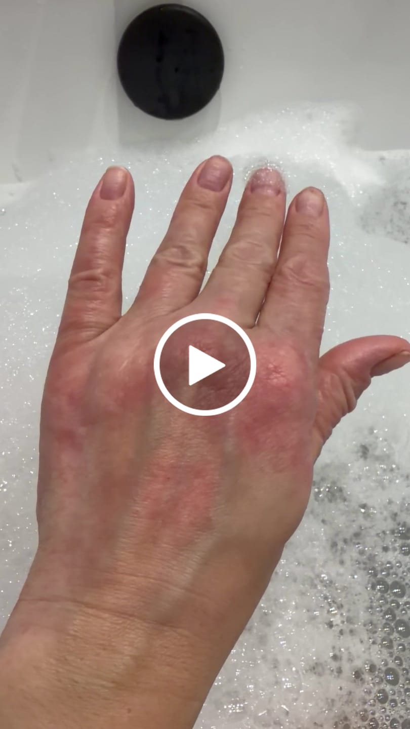 Customer video review of Multi Strain Biotic