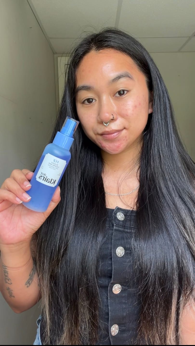 Customer photo review of Blue EGF Calming Mist