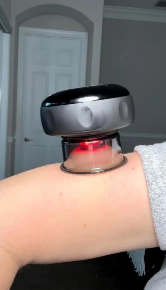 Customer photo review of VORA™ Terapia con Ventosas Inteligentes