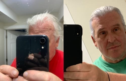 Customer photo review of Peptide Infusion Hair Regrowth System