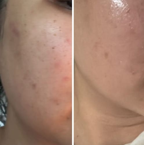 Photo d’une cliente avec le K‑Glow Booster