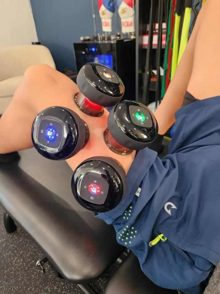 Customer photo review of VORA™ Terapia con Ventosas Inteligentes