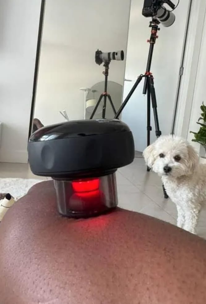 Customer photo review of VORA™ Terapia con Ventosas Inteligentes