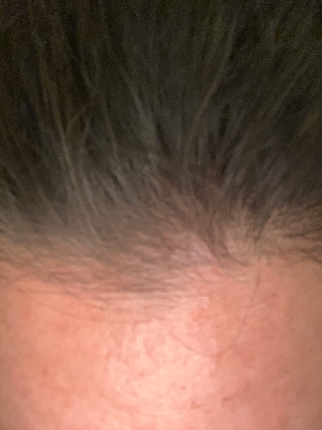 Customer photo review of VITAFOAM ™ Hair Growth Formula
