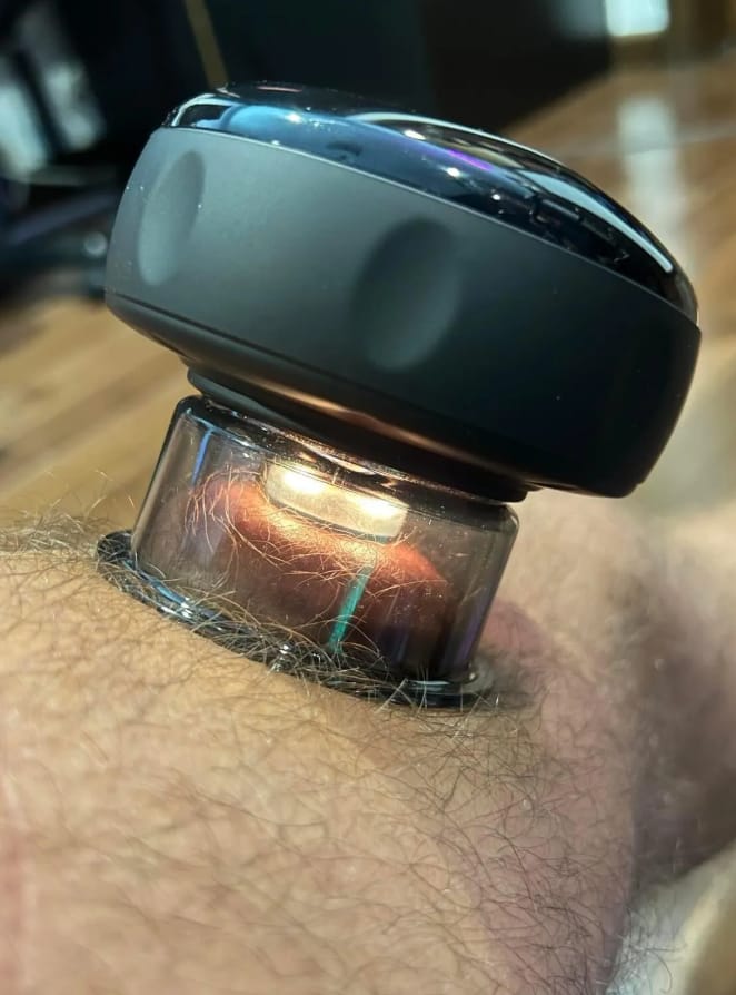 Customer photo review of VORA™ Terapia con Ventosas Inteligentes