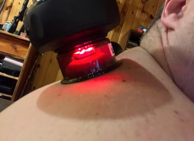 Customer photo review of VORA™ Terapia con Ventosas Inteligentes