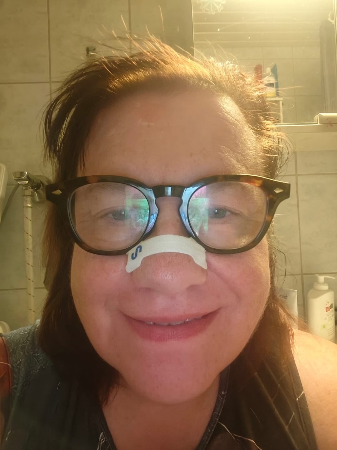 Customer photo review of Nuku Sleep Nasal Strips