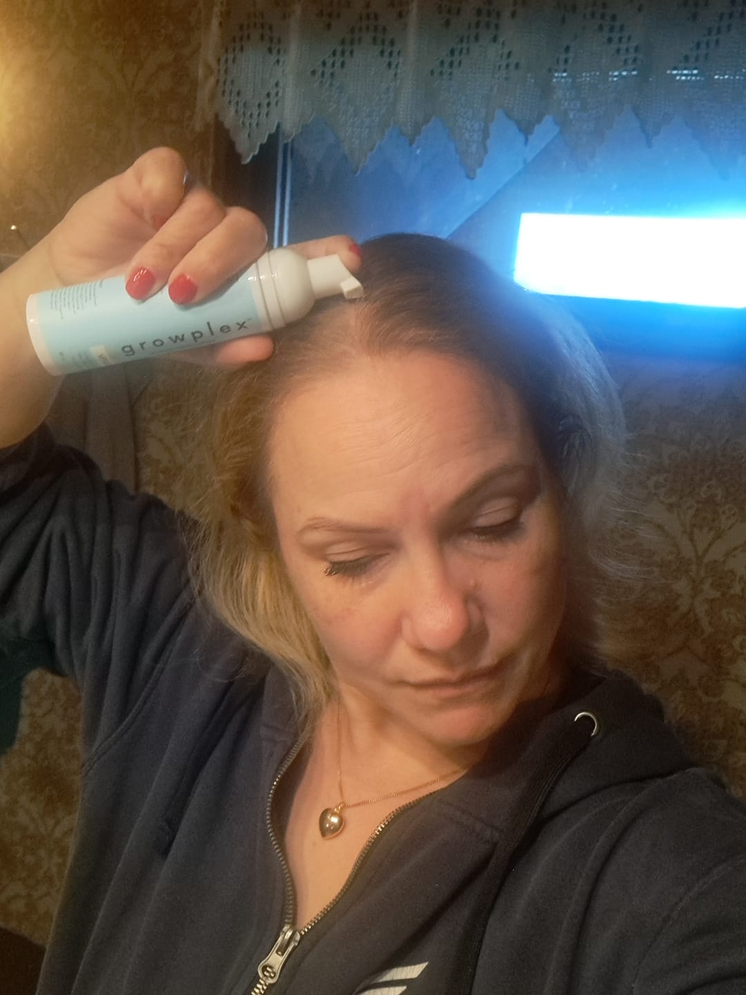 Customer photo review of VITAFOAM ™ Hair Growth Formula