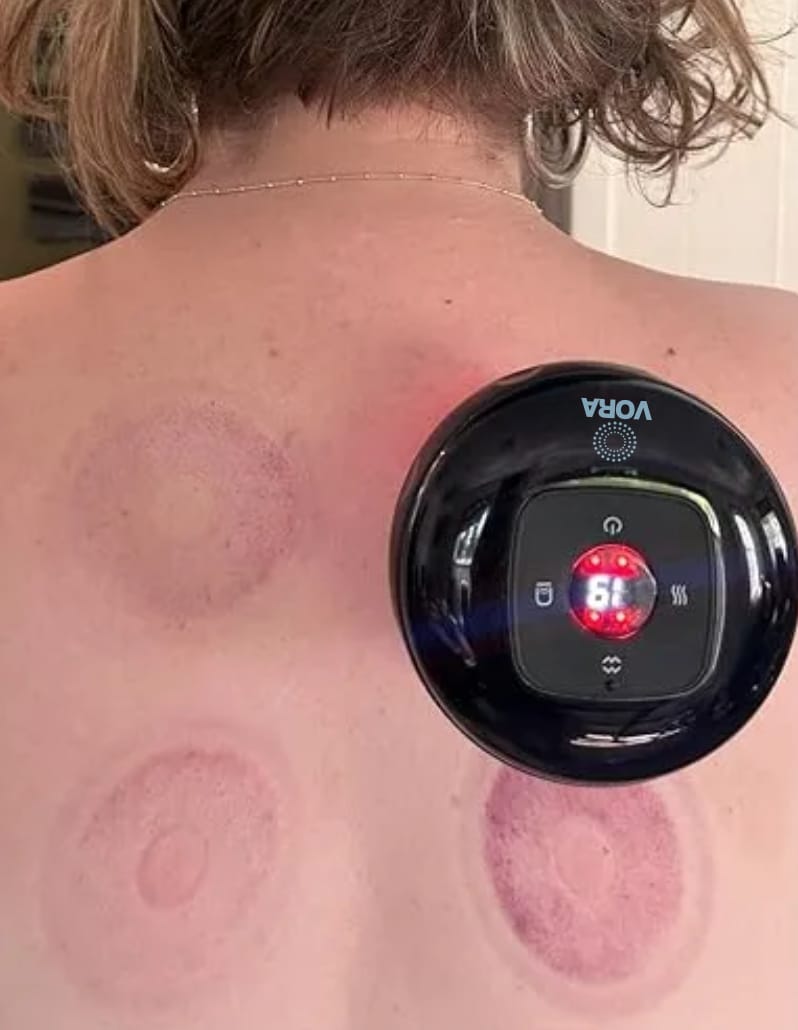Customer photo review of VORA™ Terapia con Ventosas Inteligentes