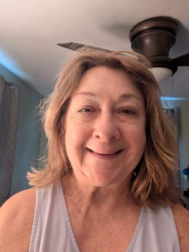 Customer photo review of The Micro Infusion System™
