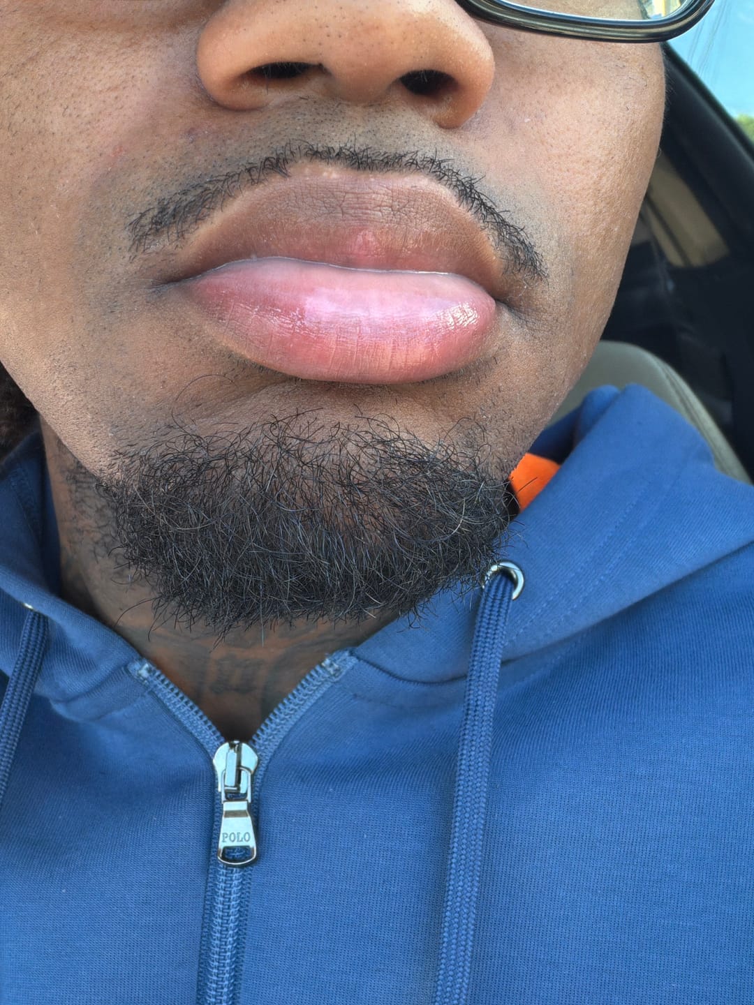 Customer photo review of Turmeric and Lemon Lip Balm (for Dark Lips)