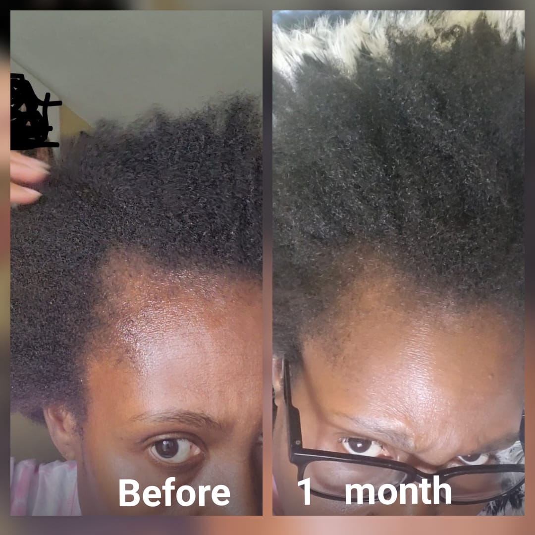 Customer photo review of Gro & Glow Liquid Vitamins - 2 Month Supply!