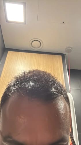 Customer photo review of Peptide Infusion Hair Regrowth System