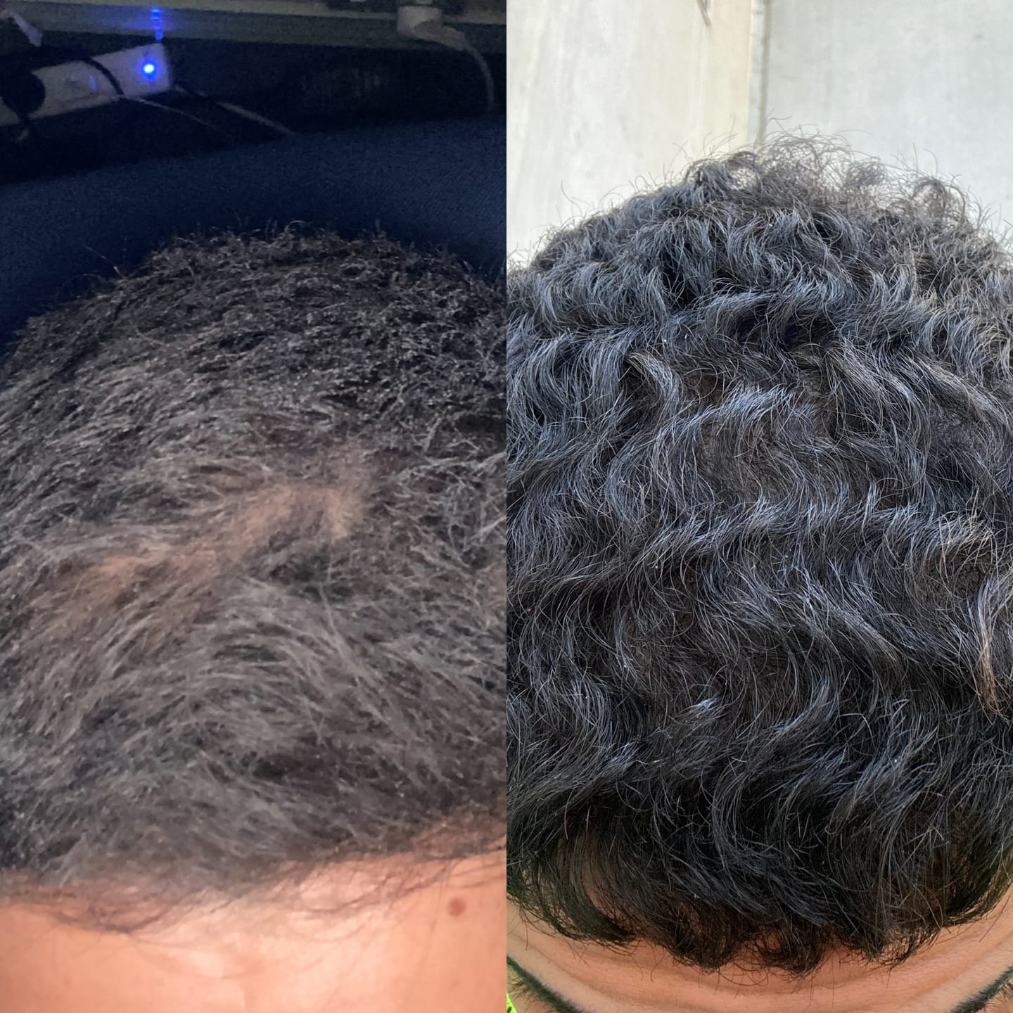 Customer photo review of 6 Month Hair Growth Bundle